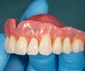 A picture of upper dentures