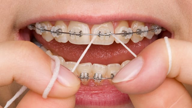 Close up of a woman flossing her braces