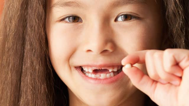A girl is smiling and showing lost tooth