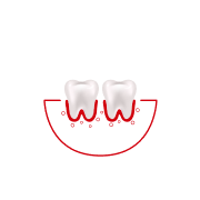 ¿Con qué frecuencia usas hilo dental o te limpias los espacios entre los dientes?