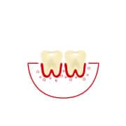 ¿Con qué frecuencia usas hilo dental o te limpias los espacios entre los dientes?