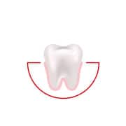 How often do you experience bleeding while brushing or flossing?