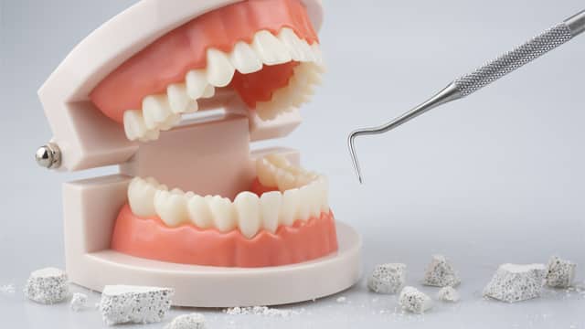 Modelo de boca con dientes blancos