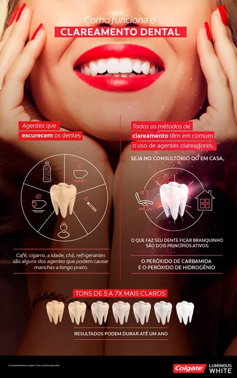 Infografía sobre aclaramiento dental