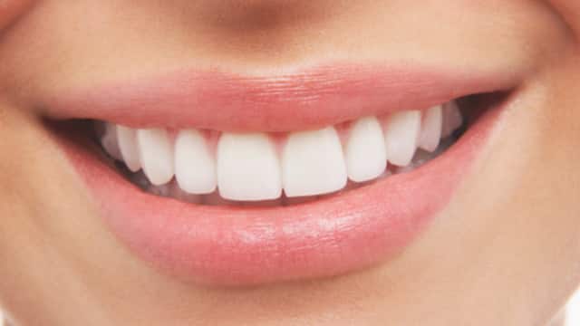 a close up picture of a smiling mouth