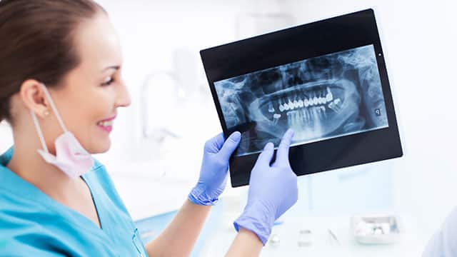 Doctor showing an x ray of the jaw