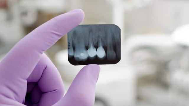 Radiografia dental