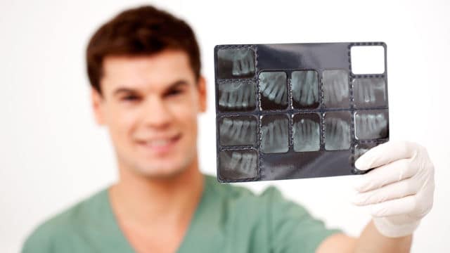 Man holding x-ray