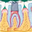 Cámara dental sellada