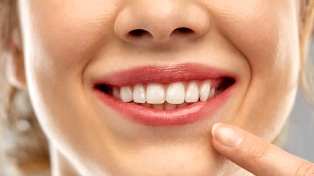 A close-up of a smiling woman pointing to her teeth