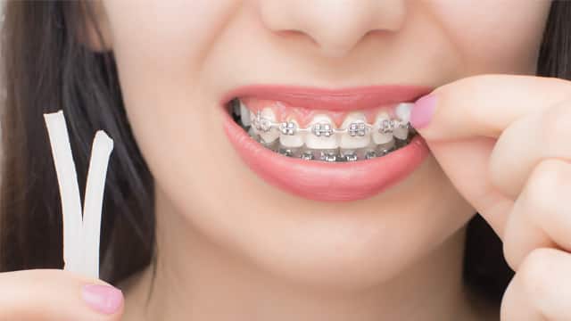 Young woman applying wax to her braces