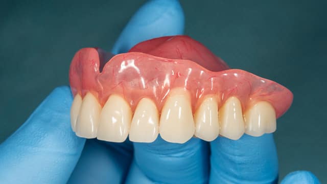 A picture of upper dentures