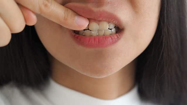 Young woman is touching her mouth with the finger
