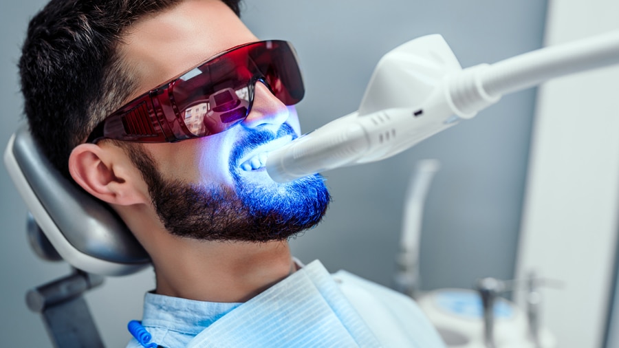 تبييض الأسنان