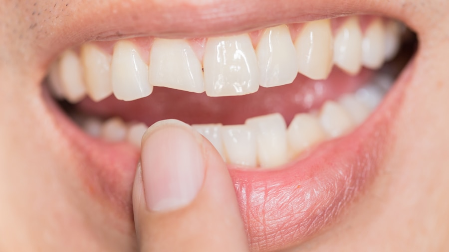 شكل الأسنان