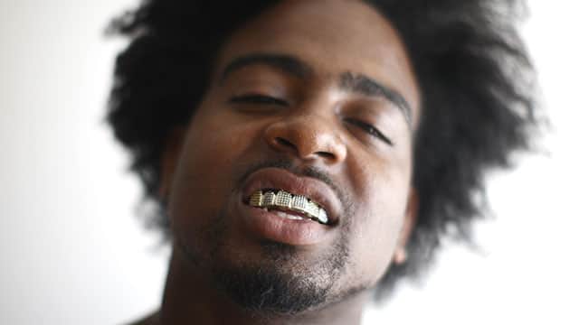 A man with dental grill