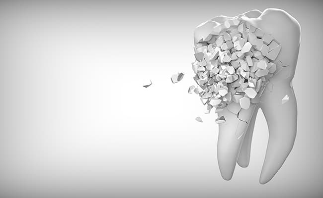 diş birkaç parçaya bölündü