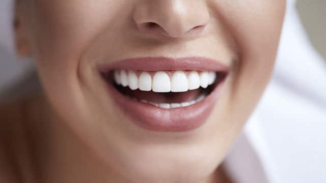 A close-up of a woman smiling and showing teeth