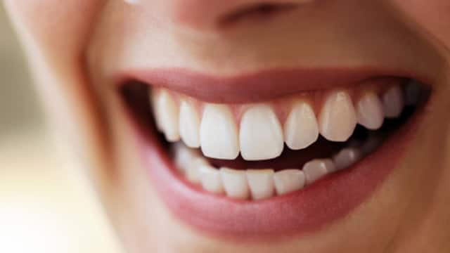 Sonrisa perfecta