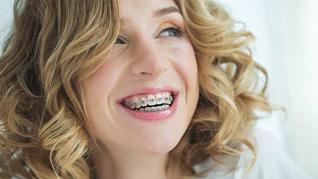 woman with braces