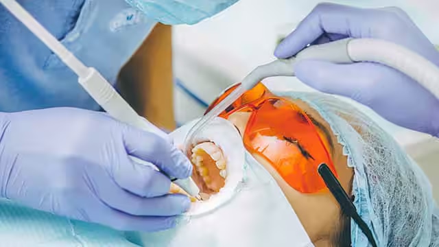 تبييض سريع للاسنان