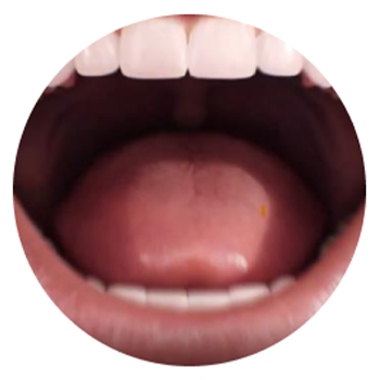mouth