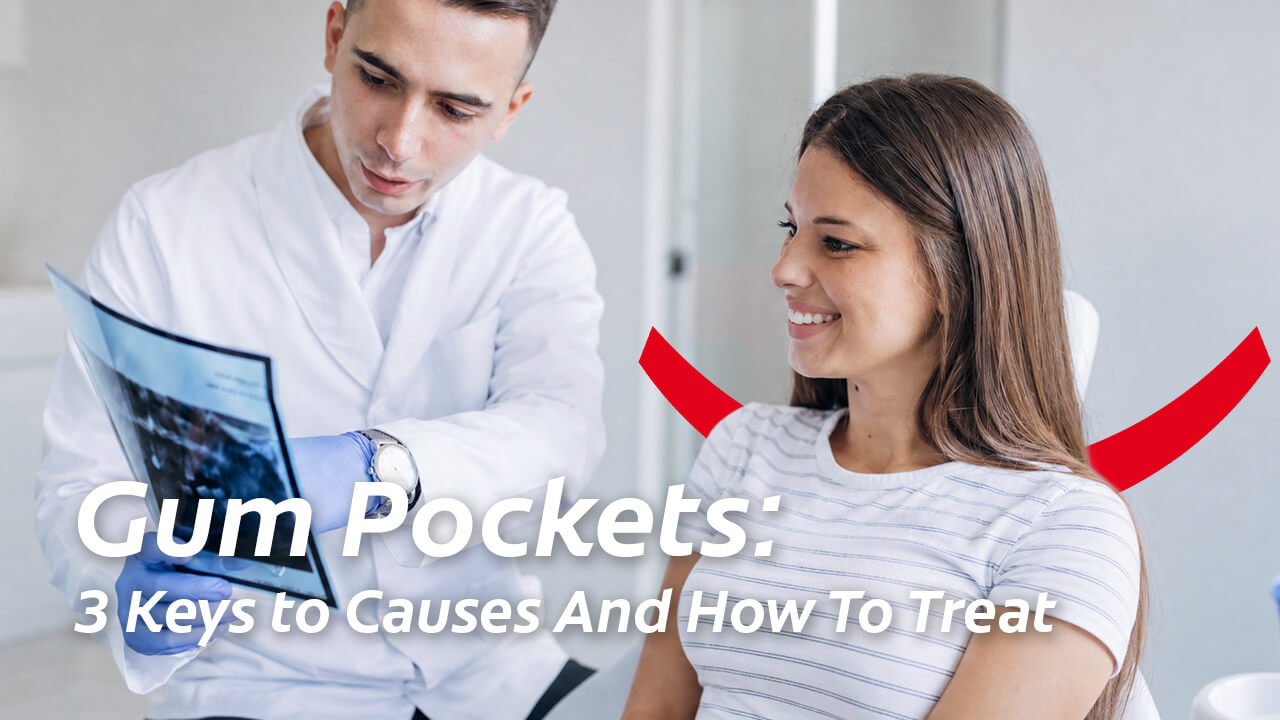 Dentist showing an X-ray to a patient with text reading Gum Pockets: 3 Keys to Causes And How To Treat.