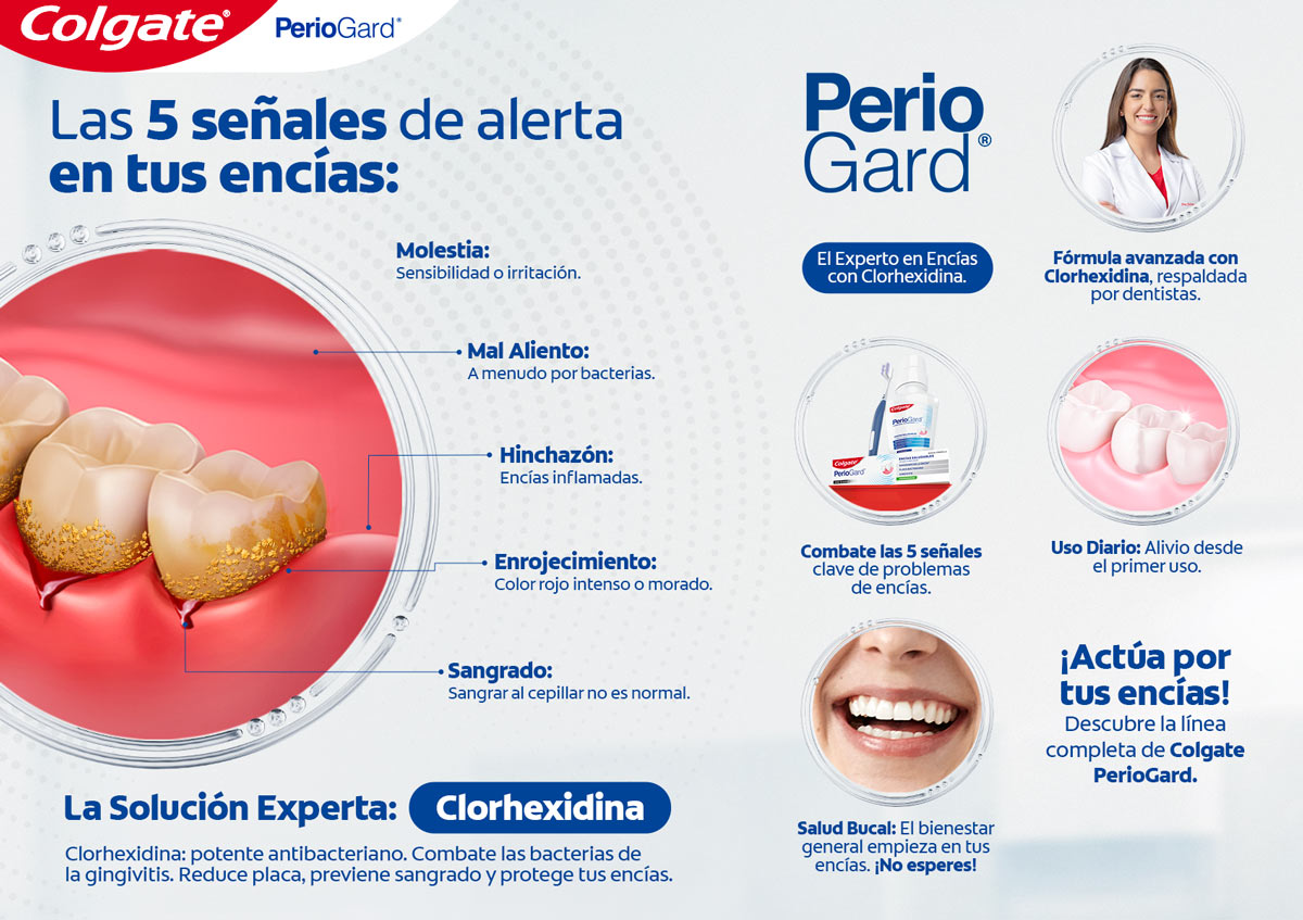 Infográfico sobre las 5 señales de alerta en tus encías. PerioGard el experto en encías.