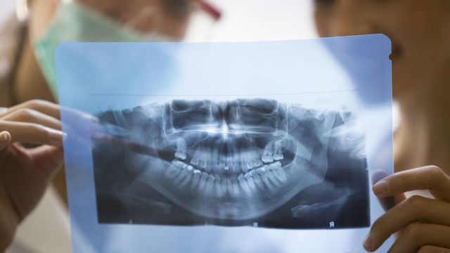Dental X-Ray
