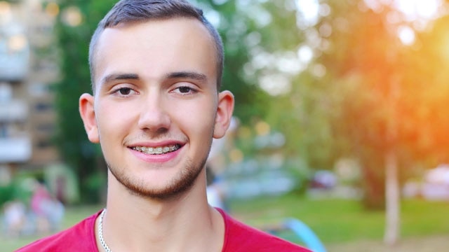 Adolescente con brackets para corrección de mordida