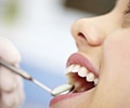 A close up of woman's face being checked by a dentist
