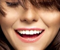Young woman smiles showing white teeth