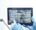 A dentist showing a teeth x-ray on a tablet