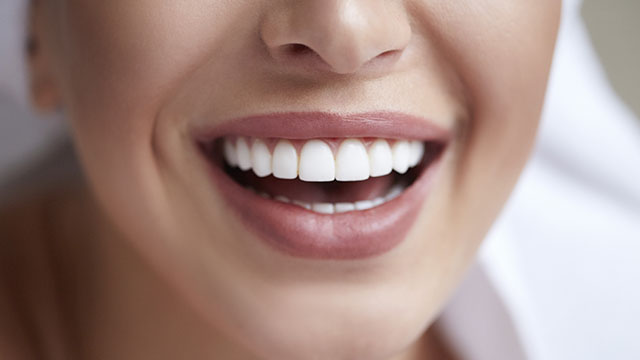 Closeup woman's white smile
