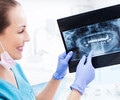 Doctor showing an x ray of the jaw