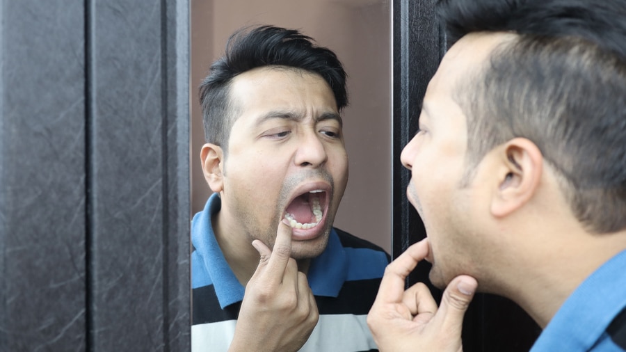 A man checking for the presence of black tartar on teeth