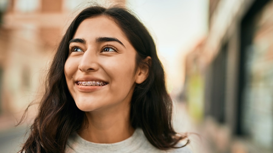 5 things you should know about damon braces - colgate india