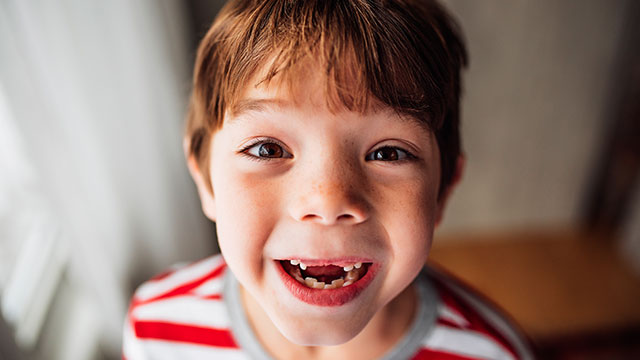 A face of the small boy with missing front teeth