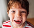 A face of the small boy with missing front teeth