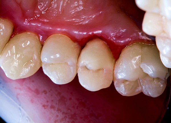 Estructura dental