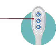 Tongue Cleaner