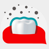 Cavity Prevention