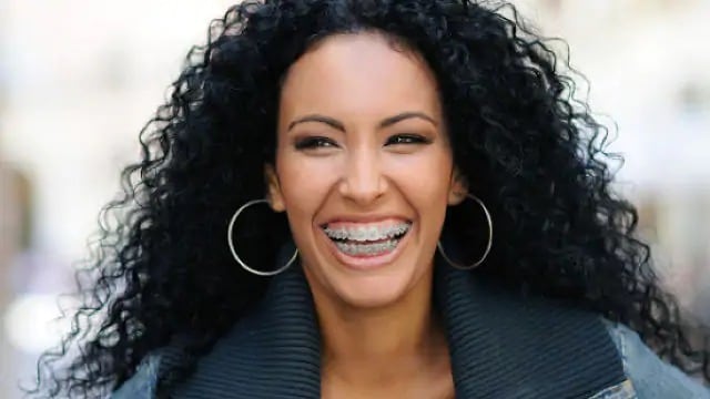 what to know about metal braces - colgate sg what to know about metal braces - colgate sg