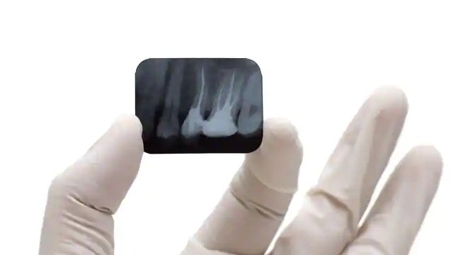 dental x-ray