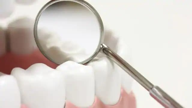 close up look at dental sealants