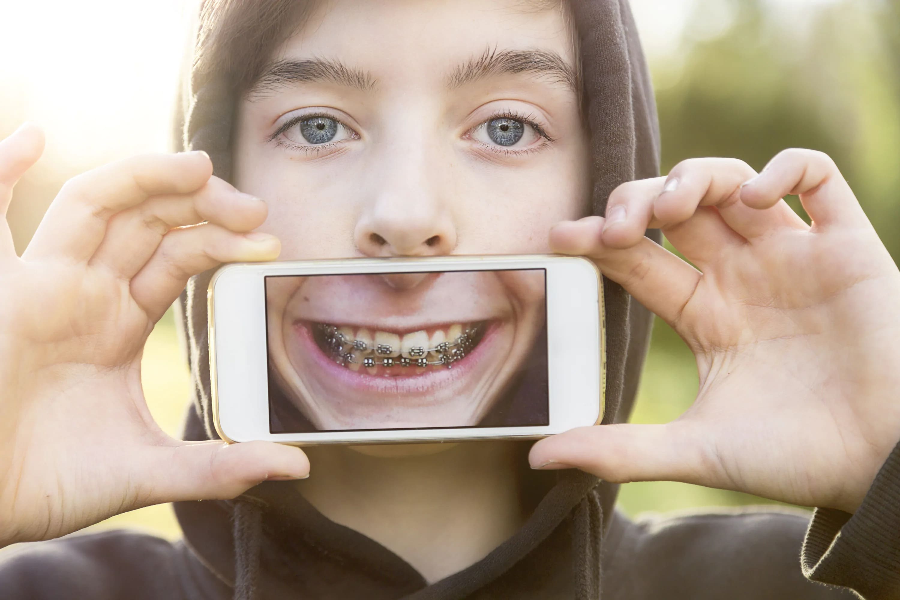 A person showing their smile with braces on a cellphone