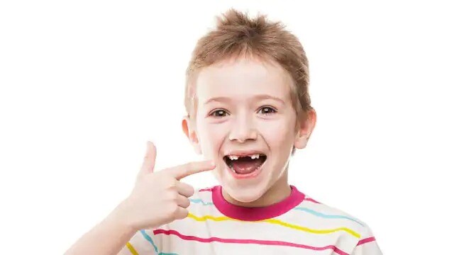 Child smiling an pointing to missing teeth