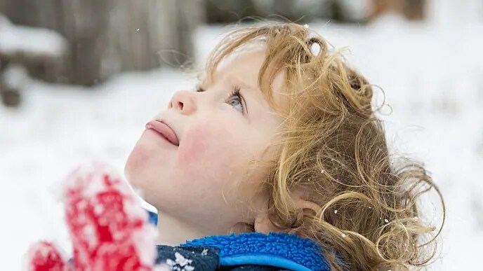 kid with macroglossia