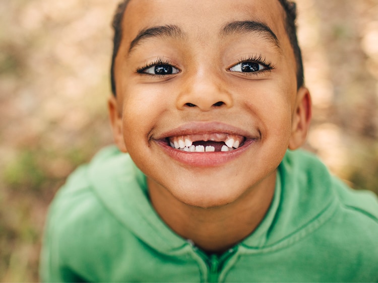 smiling child with missing teeth