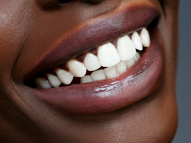 woman showing off white teeth